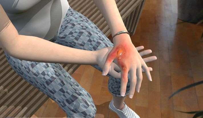 Injuries - 4